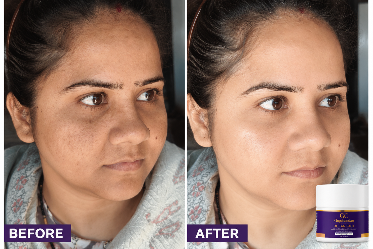 Gupchandan D-TAN Brightening Pack with Kojic Acid, Hyaluronic Acid & Niacinamide