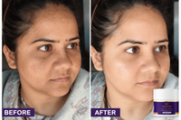 Gupchandan D-TAN Brightening Pack with Kojic Acid, Hyaluronic Acid & Niacinamide